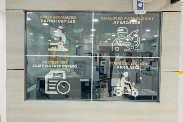 whatsapp-image-2023-12-14-at-13.17.29-2-A85ZX0XwxnfvPB9b